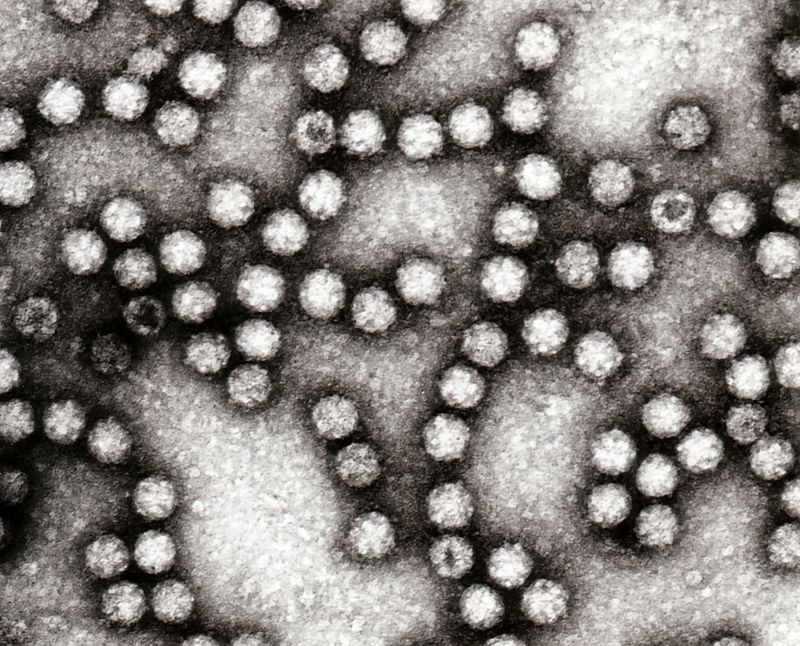 Astrovirüs 4.jpg