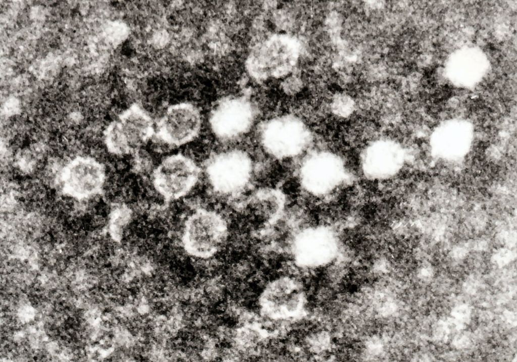 Kandaki Parvovirus.jpg