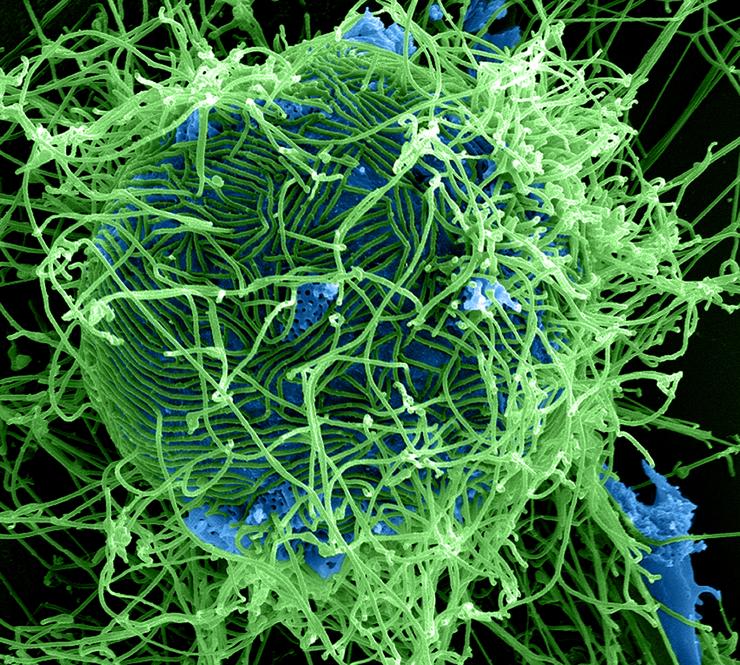 Ebola virüsleri