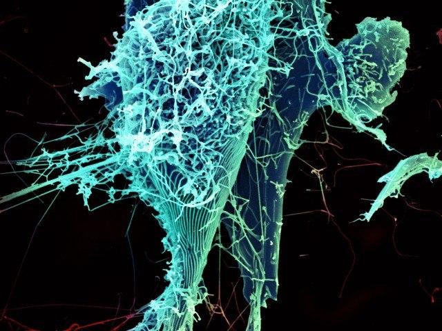 Ebola virüsü parçacıkları